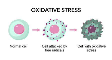 Oxidative stress. Imbalance between the production of free radicals and antioxidants. From Normal cell to attack of Free radicals and Cell death by apoptosis or necrosis.