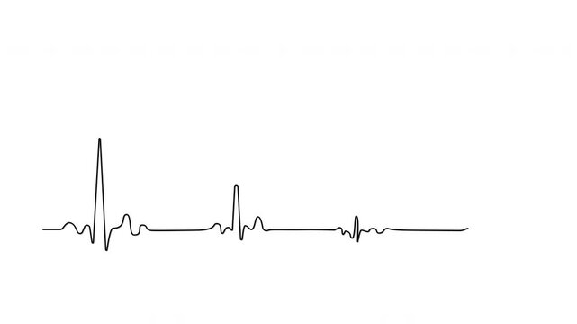 Heart failure, cardiac arrest, wave attenuation chart self drawing animation.