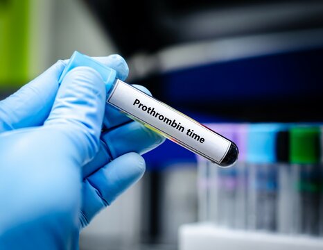 Blood sample tube for prothrombin time test analysis.