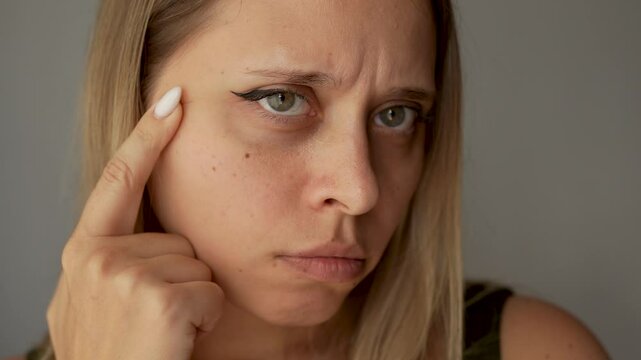 A young caucasian woman showing sunken eyes with thin skin and dark circles running her finger over her face on a dark grey background. Pale skin, bruises under the eyes are caused by disease