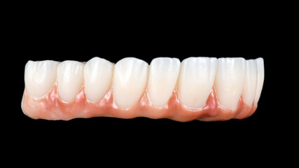 zirconium bridge on implants