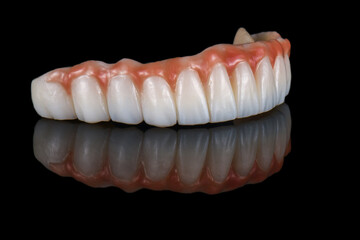 zirconium bridge on implants