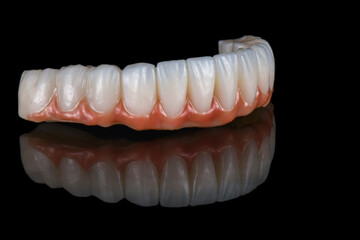zirconium bridge on implants
