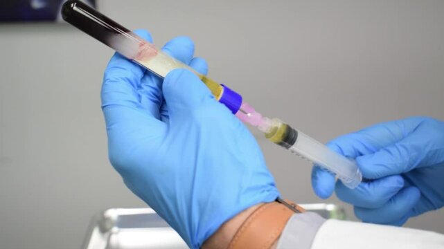 Medical Doctor Separating Layers of Blood Platelet Rich Plasma PRP White Labcoat Blue Gloves