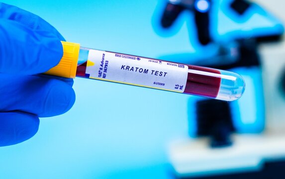 Screens for mitragynine and 7-hydroxymitragynine, the active compounds in kratom, a plant with opioid-like effects.