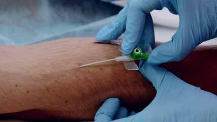 Nurse wearing blue gloves prepares and places an intravenous catheter into a patient's arm, demonstrating a crucial medical procedure for infusion and patient care
