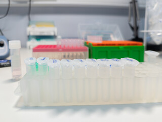 Plastic rack with eppendorf tubes in a laboratory on a working bench.  Some boxes with micropipette tips in the background. Background for science, DNA analysis.