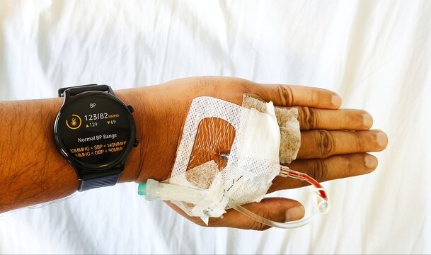 A hand with inserted medical branula and wearing smart watch showing his latest blood pressure.
