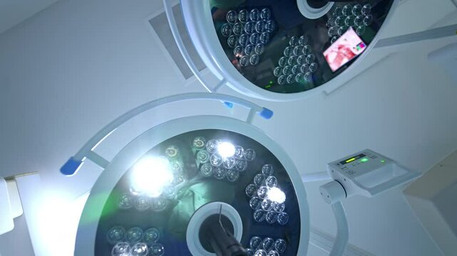 Two round lamps on the ceiling of the surgery room. One of the lamps is switched on. Low angle view at the light equipment in the hospital.