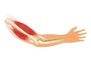 Arm muscle biceps with skeleton. Muscle tension of human hand on white background. Bones and joints in male silhouette. Medical vector illustration of hand for clinic or hospital