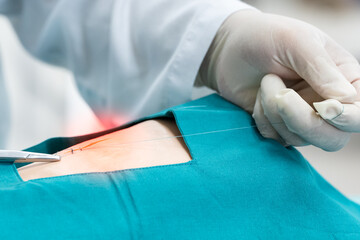 Doctor hand wear sterile gloves and surgery scissor stitching up wound after surgery.Plastic surgeon placing sutures after plastic surgery in operating room.Nurse teaches the technique of suturing.