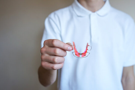 Orthodontic Palatal Expander in Hand