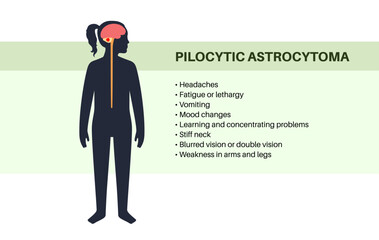 Pilocytic astrocytoma poster