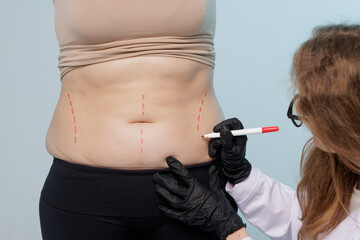 Close up of doctor drawing marks on woman body before plastic surgery. Patient in black underwear...