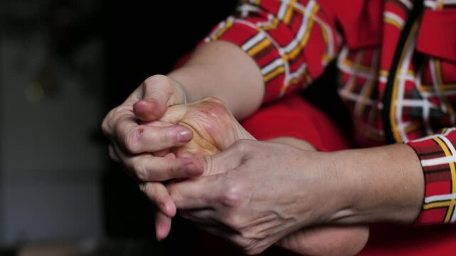 woman massages swollen bone on edge of big toe to relieve pain. hallux valgus or formation of bone on foot. Women's health concept
