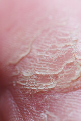 Macro texture of scaly and dried human foot texture