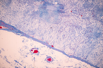 Showing Light micrograph of the Adrenal gland, Spleen human and Other human tissues under the...