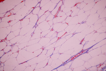 Showing Light micrograph of the Adrenal gland, Spleen human and Other human tissues under the...