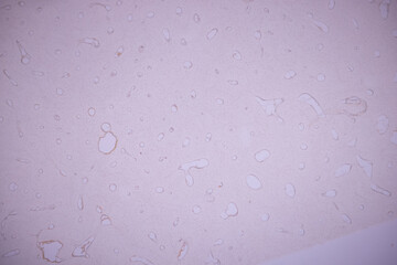 Showing Light micrograph of the Adrenal gland, Spleen human and Other human tissues under the...