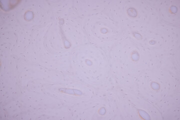 Showing Light micrograph of the Adrenal gland, Spleen human and Other human tissues under the...