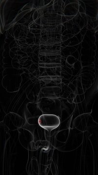 Close up of Bladder Cancer indication X-ray Vertical HQ Video | Bladder Cancer indication X-ray HQ Vertical