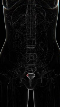 Bladder Cancer indication X-ray Vertical HQ Video