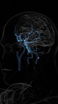 Ischemic Brain Stroke in Vertical HQ Video | Stroke Ischemic Vertical HQ Video | Brain Stroke