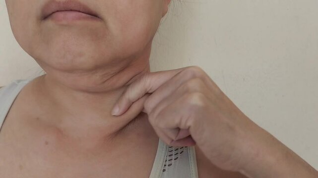 Portrait the fingers holding the flabbiness adipose sagging skin under the neck, wattle and cellulite on the throat, large and layer skin on the body, health care and beauty concept.