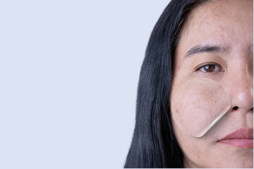 Enlarged circles indicate facial skin problems such as blemishes, freckles, uneven skin tone and...