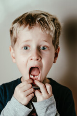 ERste ZAhnl&uuml;cke eines f&uuml;nf JAhre alten Jungen