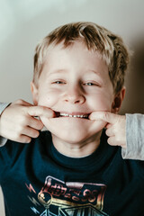 ERste ZAhnl&uuml;cke eines f&uuml;nf JAhre alten Jungen