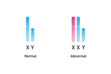 Klinefelter Syndrome Science Design. Vector Illustration.