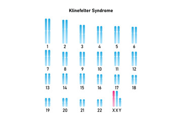 Klinefelter Syndrome Science Design. Vector Illustration.