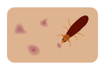 Flea causing skin irritation and red spots