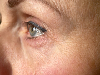 Macro Close-up of an Aging Woman’s Eye with Wrinkles and Natural Skin Texture