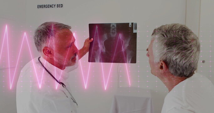 Image of cardiograph over caucasian male doctors holding xray - Powered by Adobe