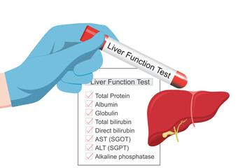 Liver function tests are blood tests that measure different substances produced.