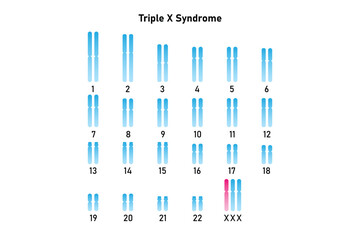 Triple X Syndrome Science Design. Vector Illustration.