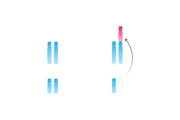 Translocation Down Syndrome Science Design. Vector Illustration.