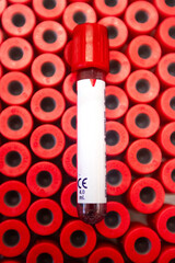 Vacuum tubes for collection and blood samples in medical laboratory with red background