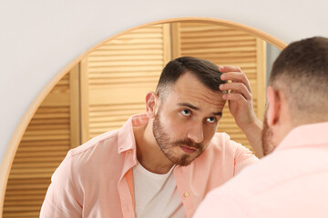 Obraz premium Baldness problem. Man with receding hairline near mirror at home