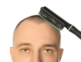 Baldness problem. Man brushing his hair on white background, closeup