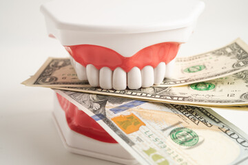 Treatment dental care cost, dental expense or fee, Euro banknote money with teeth model.