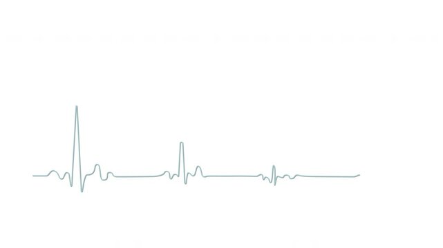 Heart failure, cardiac arrest, wave attenuation chart self drawing animation. Animated blue line on white background.