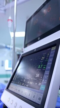 Standing at the side of the monitors of lung ventilator. Equipment in the operating room. Vertical video.