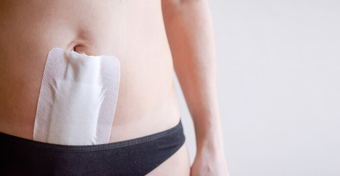 Woman recovering abdomen after gynecological operation hysterectomy or laparotomy, covered with medical white tape, close-up, copy space