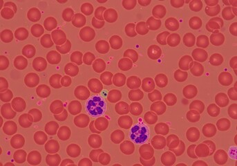 Fototapeta premium Light Micrograph of Human Red Blood Cells with White Blood Cells Centered