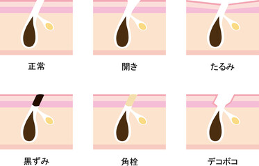 毛穴の断面　セット