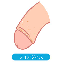 フォアダイス　男性生殖器にできたぶつぶつ