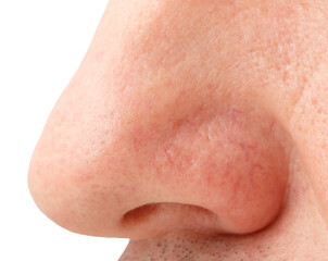 Fototapeta premium Man's nose isolated on white background.